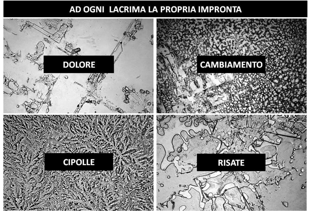 Lacrime al microscopio